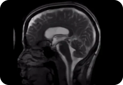 The Art of Breathing Through the Nose