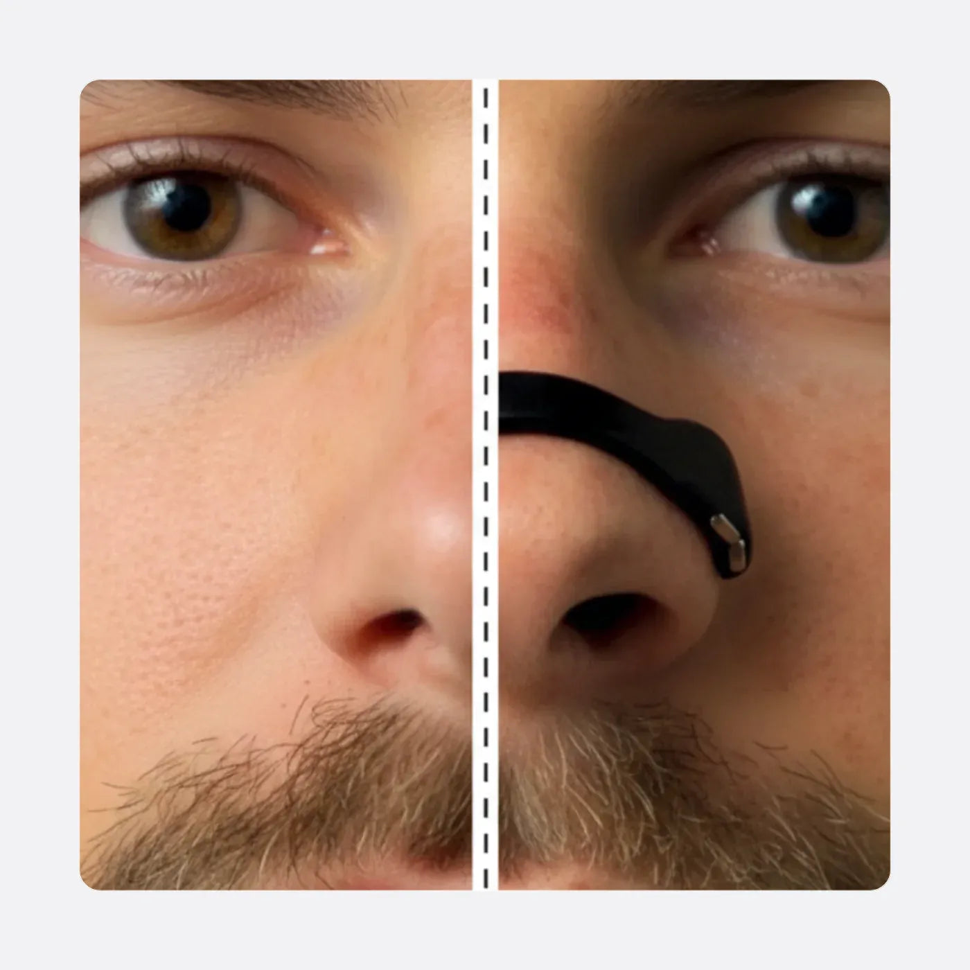 Before and after: nostrils held open with Airflow Max